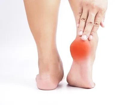 Find the root of your heel pain: common causes and treatments